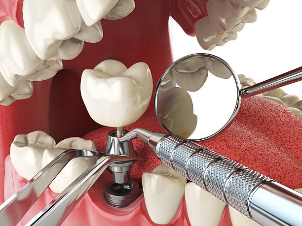Best Emergency Care for Gum Disease in Kerman, CA